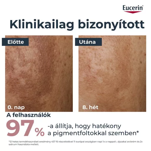 Eucerin Anti-Pigment nappali arckrém SPF30 50 ml