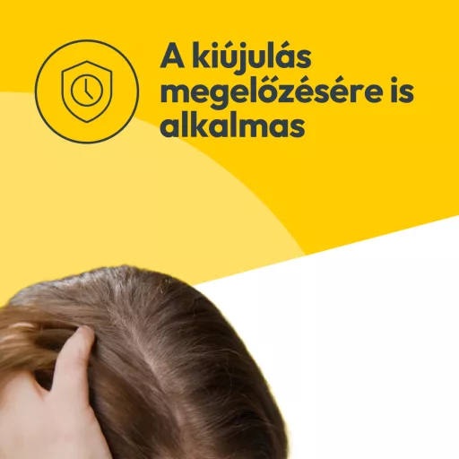 Nizoral sampon korpásodás ellen 20 mg/g 100 ml
