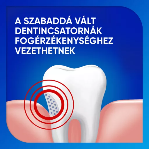 Sensodyne Extra Whitening fogkrém 75 ml