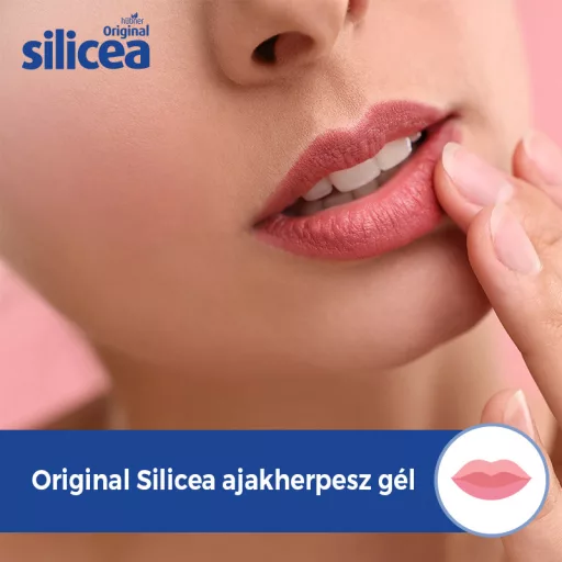 Hübner Silicea gél ajakherpeszre 2 g