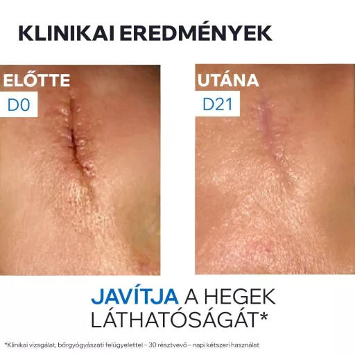 Uriage Bariéderm Cica CU-ZN sebkezelő krém 40 ml