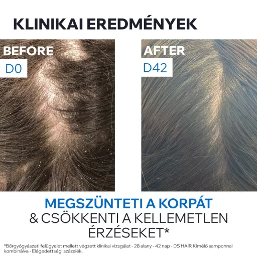 Uriage D.S. Hair sampon korpás fejbőrre 200 ml