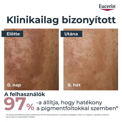 Eucerin Anti-Pigment Duál szérum 30 ml