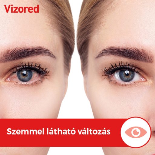 Vizored 0,5 mg/ml oldatos szemcsepp 10 ml