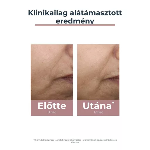 Eucerin Anti-Pigment színezett nappali arckrém medium SPF30 50 ml