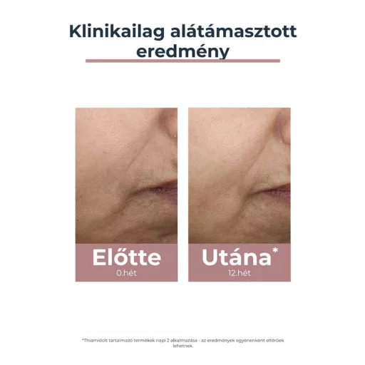 Eucerin Anti-Pigment színezett nappali arckrém light SPF30 50 ml