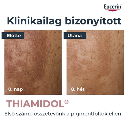 Eucerin Anti-Pigment bőrtökéletesítő szérum 30 ml