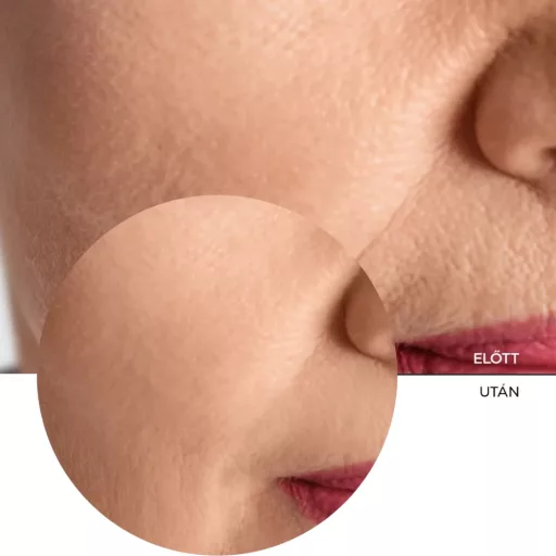 Revox B77 Just Collagen Aminoa + Ha szérum 30 ml
