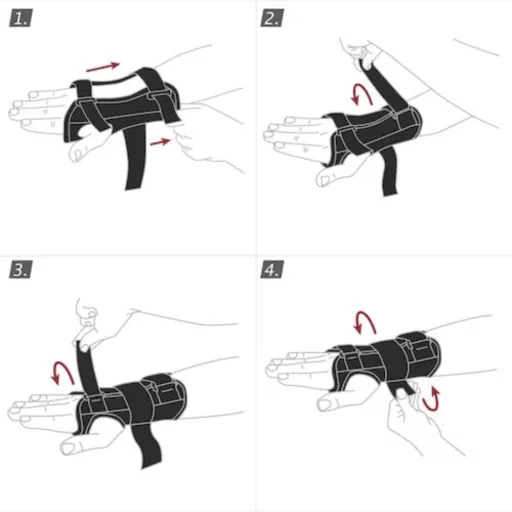 Actimove Manus Forte csuklórögzítő bal L/XL
