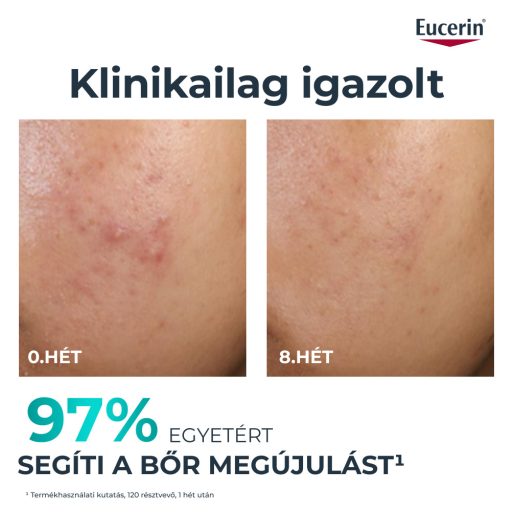 Eucerin DermoPure Clinical Peeling 10 bőrmegújító szérum 40 ml