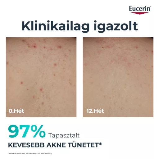 Eucerin DermoPure Clinical Correcting Body Care testkrém 200 ml