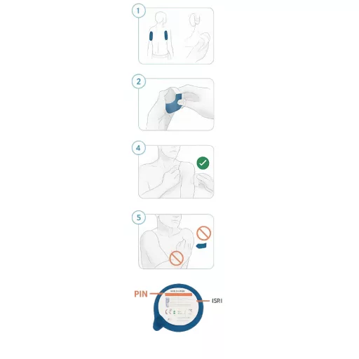 Accu-Chek SmartGuide CGM vércukormonitorozó rendszer